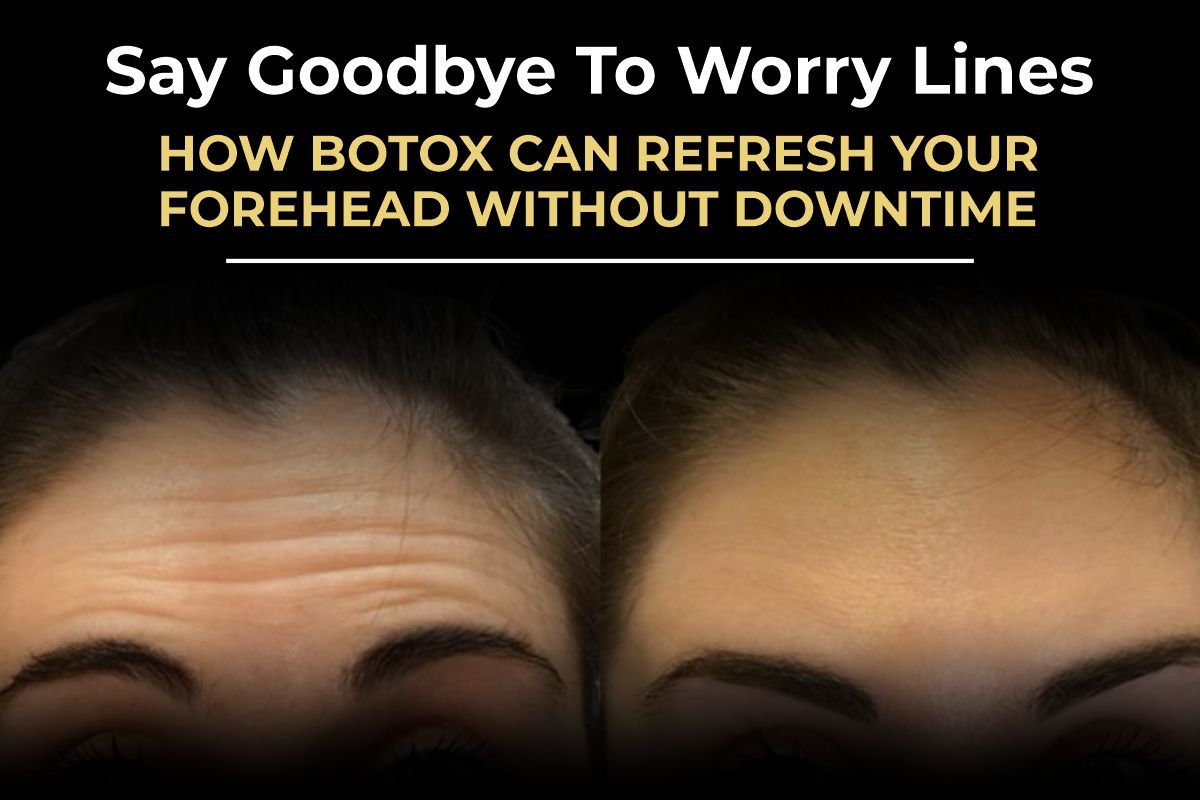 Forehead Botox results before and after by Consultant Surgeon Dr. Salman Aesthetics Pakistan.