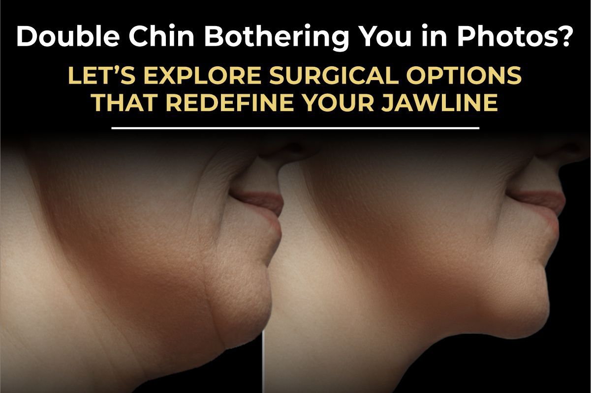 Double chin surgery results before and after by Consultant Surgeon Dr. Salman Aesthetics.