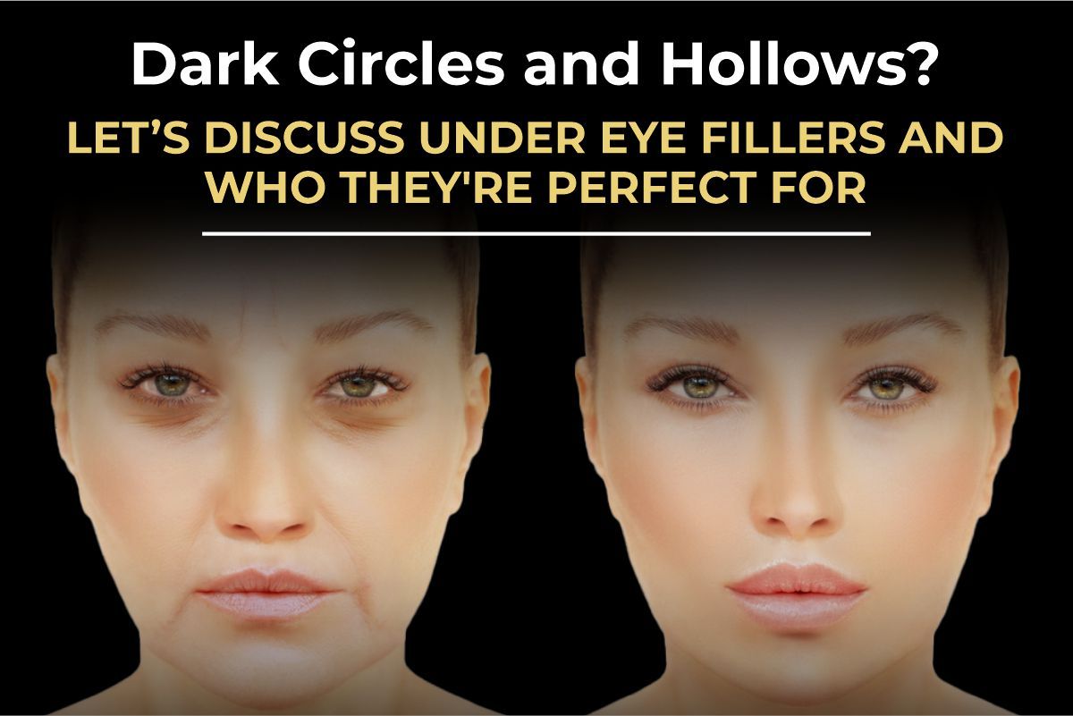 Under-eye tear trough filler results by Consultant Surgeon Dr. Salman Aesthetics Pakistan.