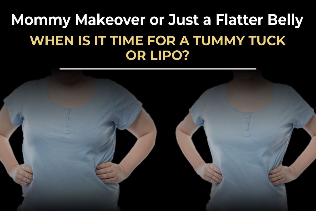 Tummy tuck and mommy makeover results by Consultant Surgeon Dr. Salman Aesthetics Pakistan