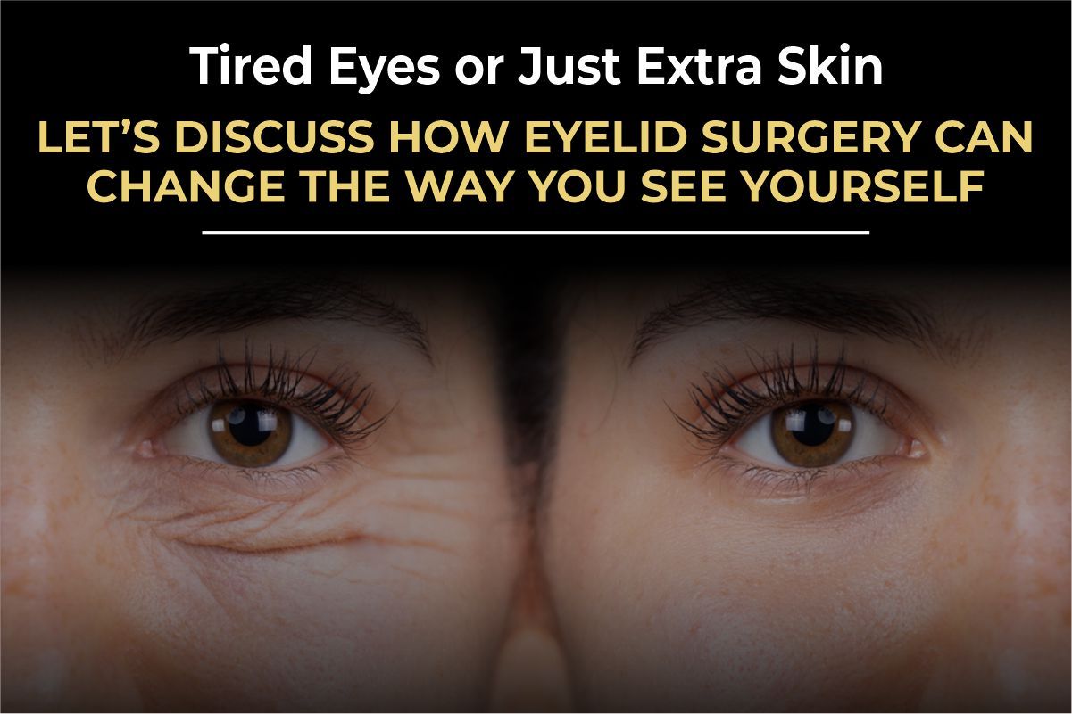 Tired Eyes or Just Extra Skin? The Surgeon’s Guide to Eyelid Surgery (2026)
