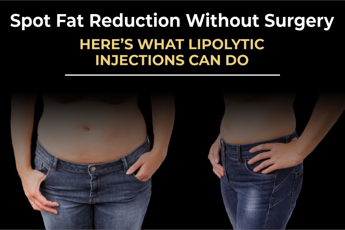 Lipolytic Injections in Pakistan: The Science of Non-Surgical Fat Dissolving (2026)