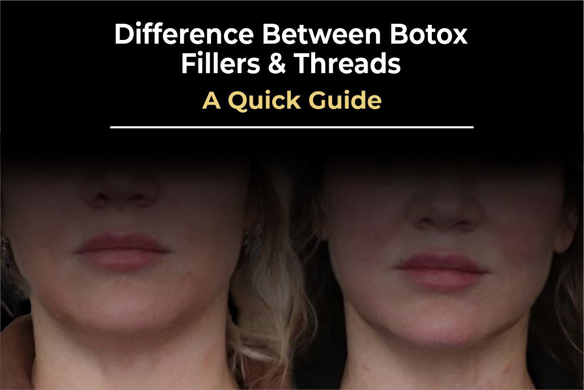 Botox, Fillers, or Threads? The Ultimate Guide to Non-Surgical Rejuvenation (2026)