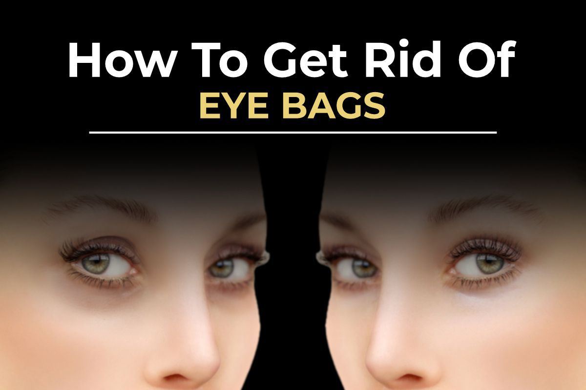 Lower blepharoplasty eye bag removal results by Consultant Surgeon Dr. Salman Aesthetics Pakistan.