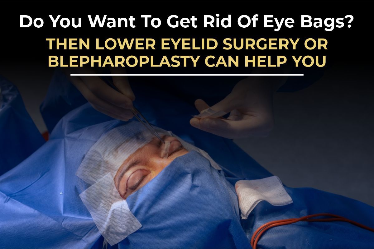 How to Get Rid of Eye Bags: The Surgeon’s Guide to Lower Blepharoplasty (2026)
