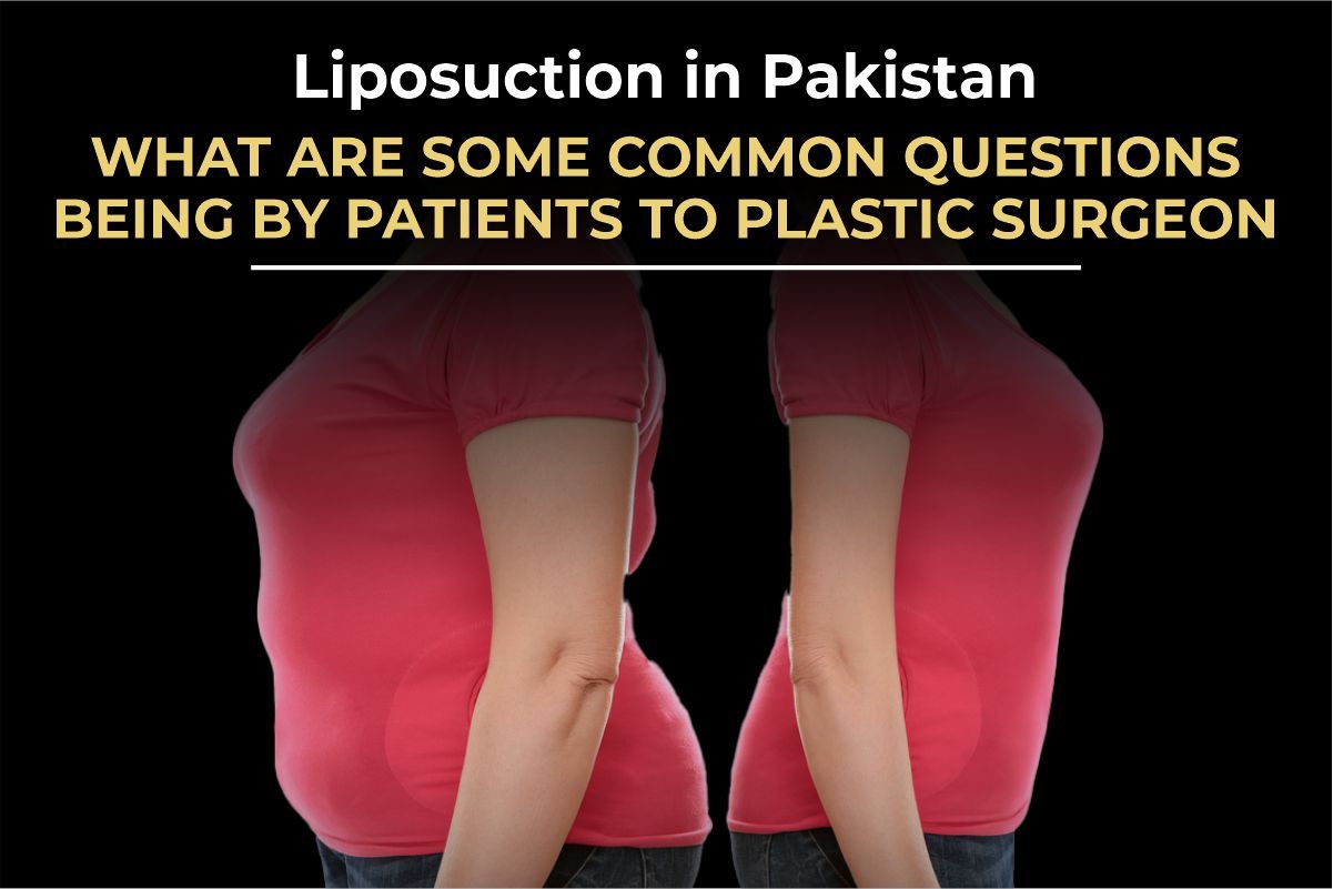 Liposuction in Pakistan: Top 10 Questions Patients Ask Plastic Surgeons (2026)