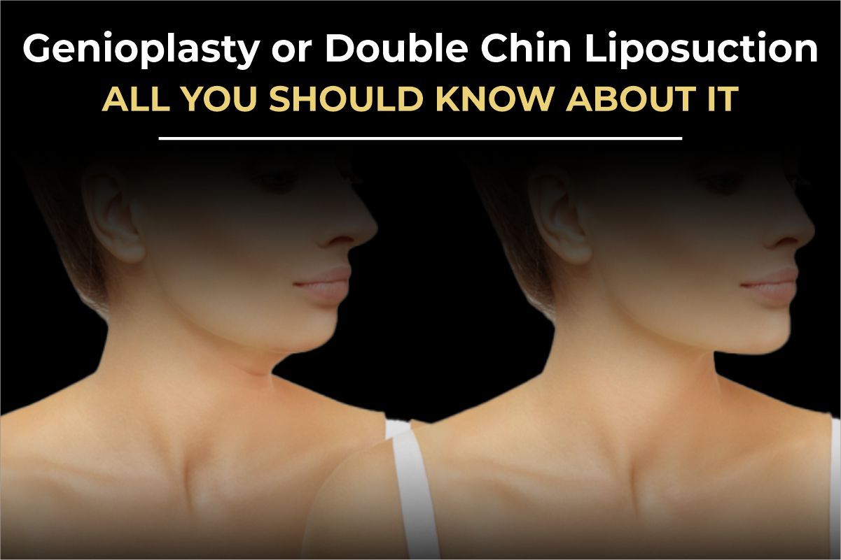 Genioplasty vs. Double Chin Liposuction: The Secret to a Chiseled Jawline in Pakistan