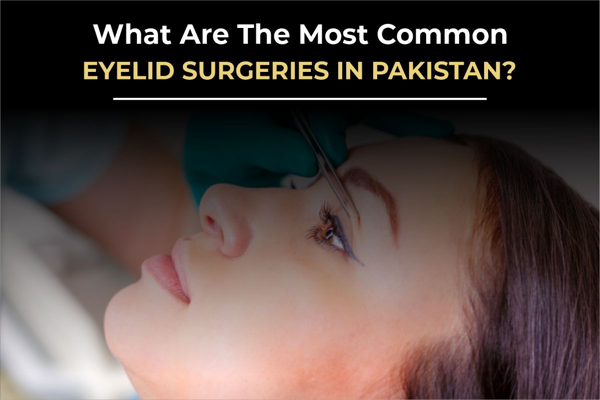 Eyelid Surgery in Pakistan: A Surgeon’s Guide to Rejuvenating Tired Eyes (2026)