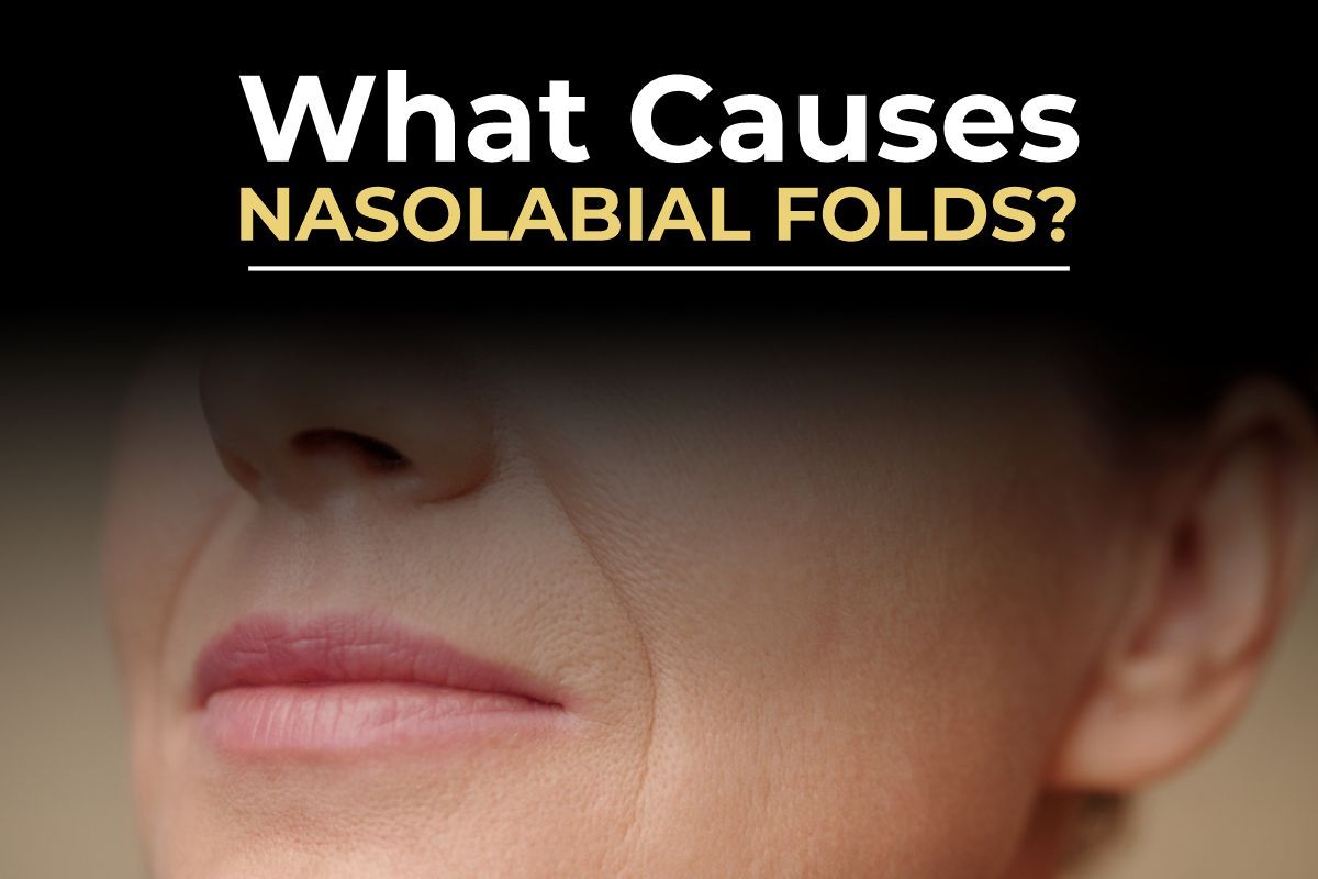 Nasolabial fold filler results before and after by Consultant Surgeon Dr. Salman Aesthetics Pakistan.