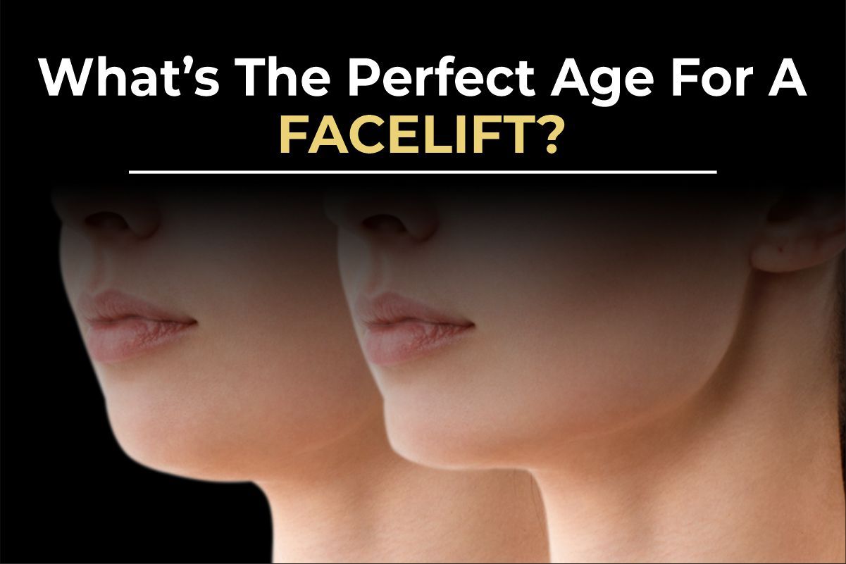 Facelift before and after results for patients in their 40s and 50s by Dr. Salman Aesthetics