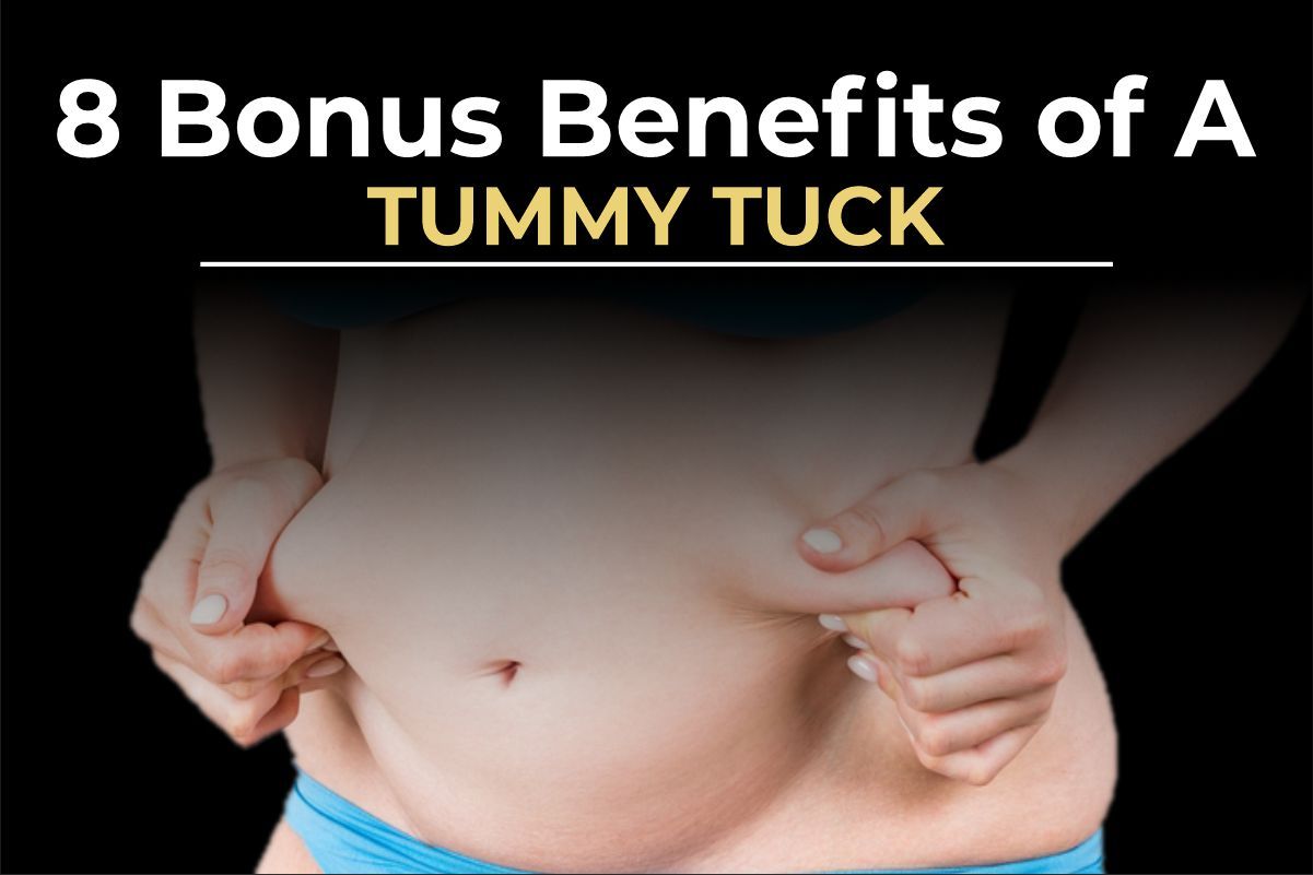 Tummy tuck surgery before and after results for muscle repair by Dr. Salman Aesthetics.