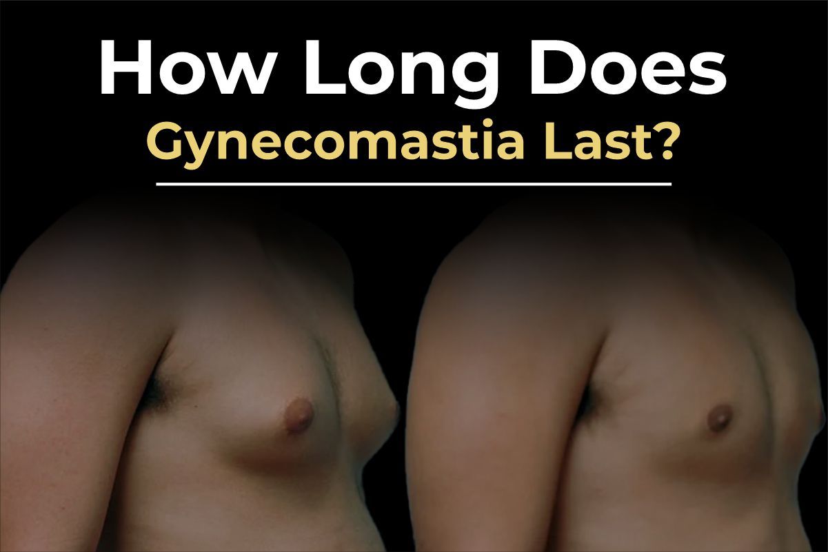 Gynecomastia surgery results and recovery timeline by Consultant Surgeon Dr. Salman Aesthetics.