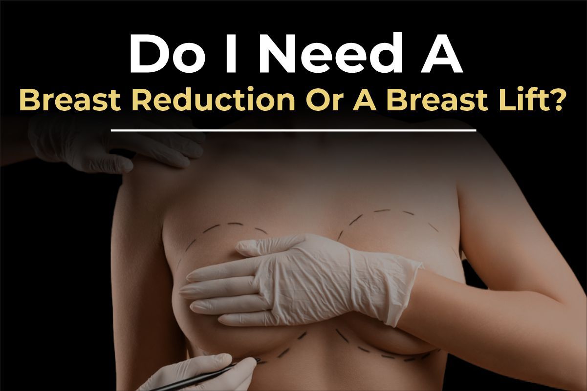 Breast lift and reduction before and after results by Consultant Surgeon Dr. Salman Aesthetics Pakistan.